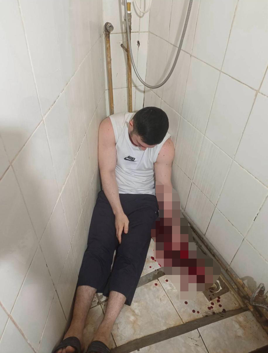 Mansur Movlayev after his suicide attempt. Photo: Lawyer Vadim Drozdov