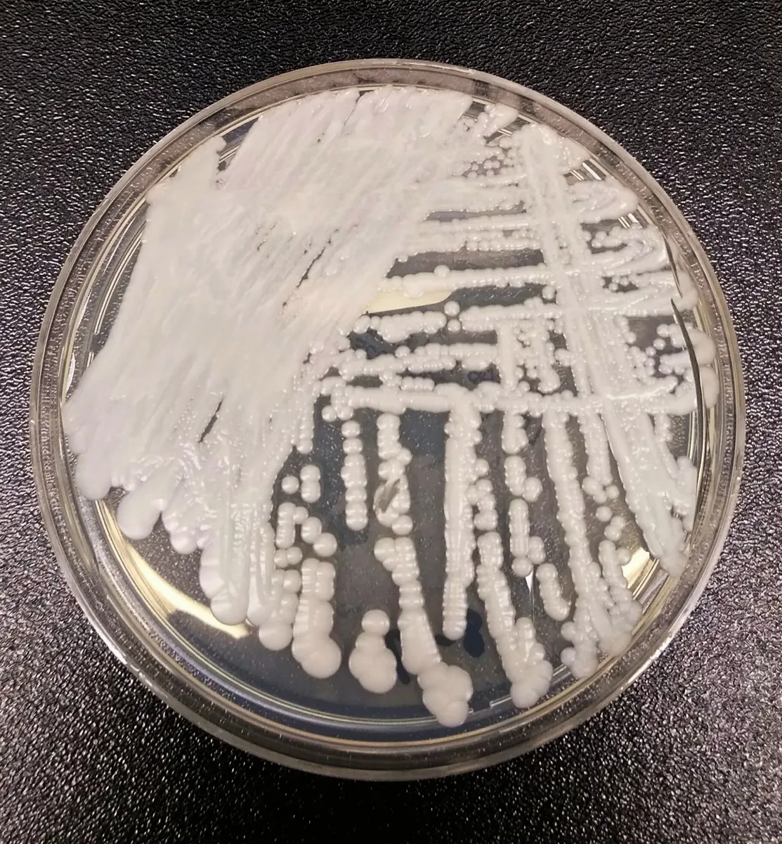 Candida auris. Фото: <a href="https://commons.wikimedia.org/w/index.php?curid=54680002">Wikimedia Commons</a>
